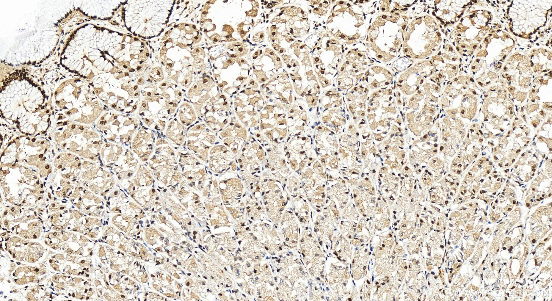 IHC staining of human stomach using 10476-1-AP