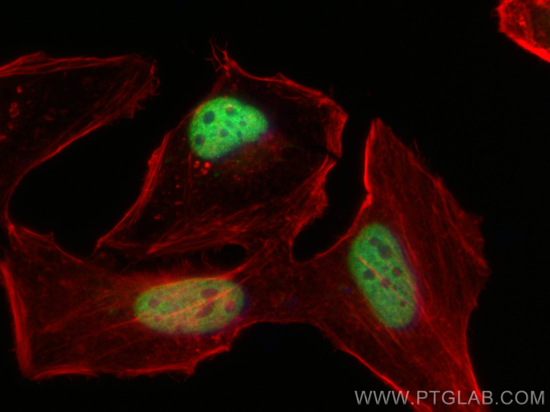 IF Staining of HeLa using 10476-1-AP