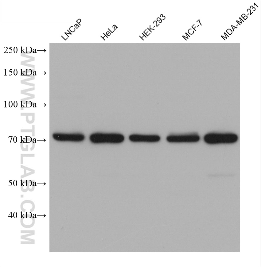 WB analysis using 68922-1-Ig