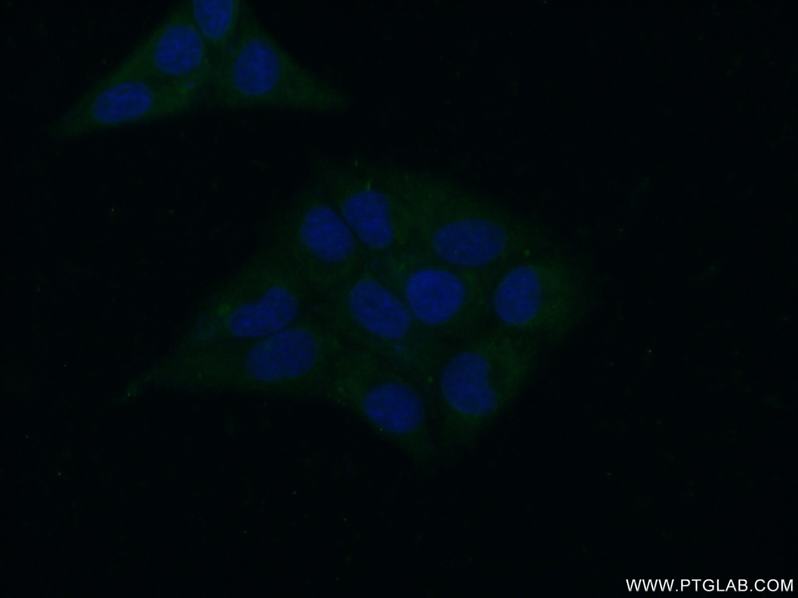 IF Staining of HepG2 using 20169-1-AP