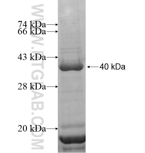 BRP16 fusion protein Ag13998 SDS-PAGE