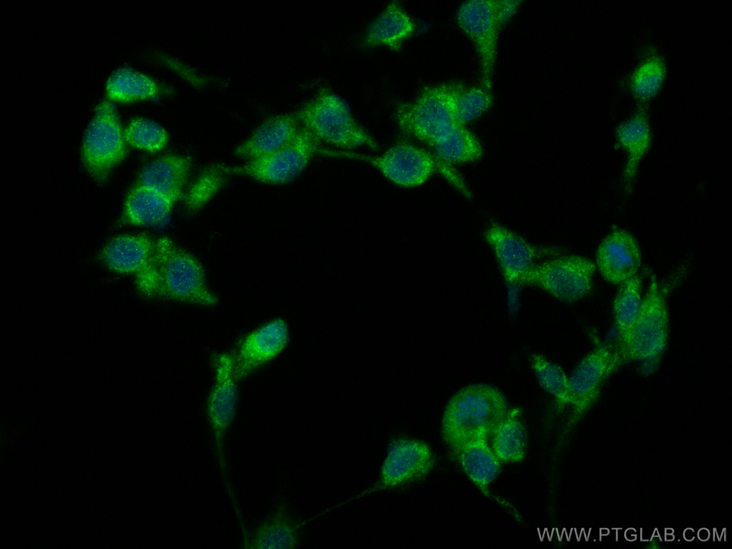 IF Staining of U-87 MG using 13557-1-AP