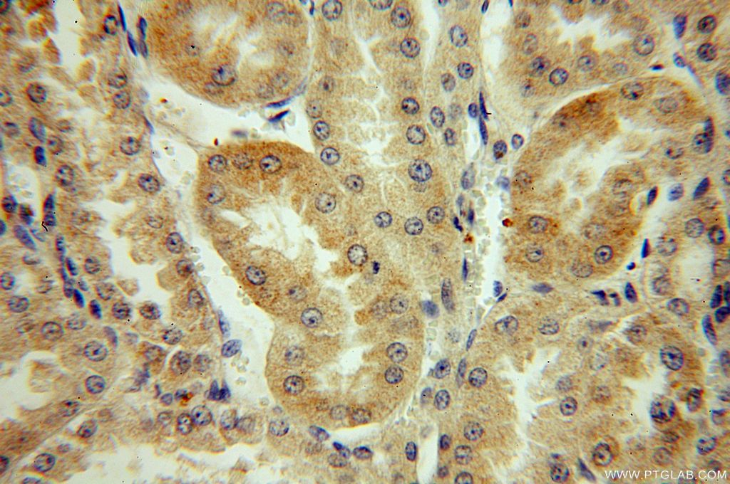 IHC staining of human kidney using 19078-1-AP