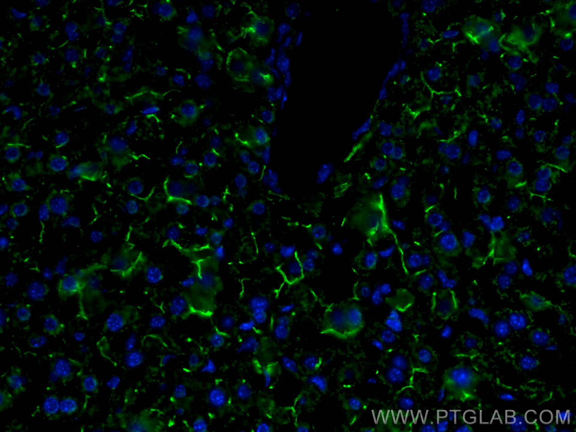IF Staining of mouse liver using 67512-1-Ig