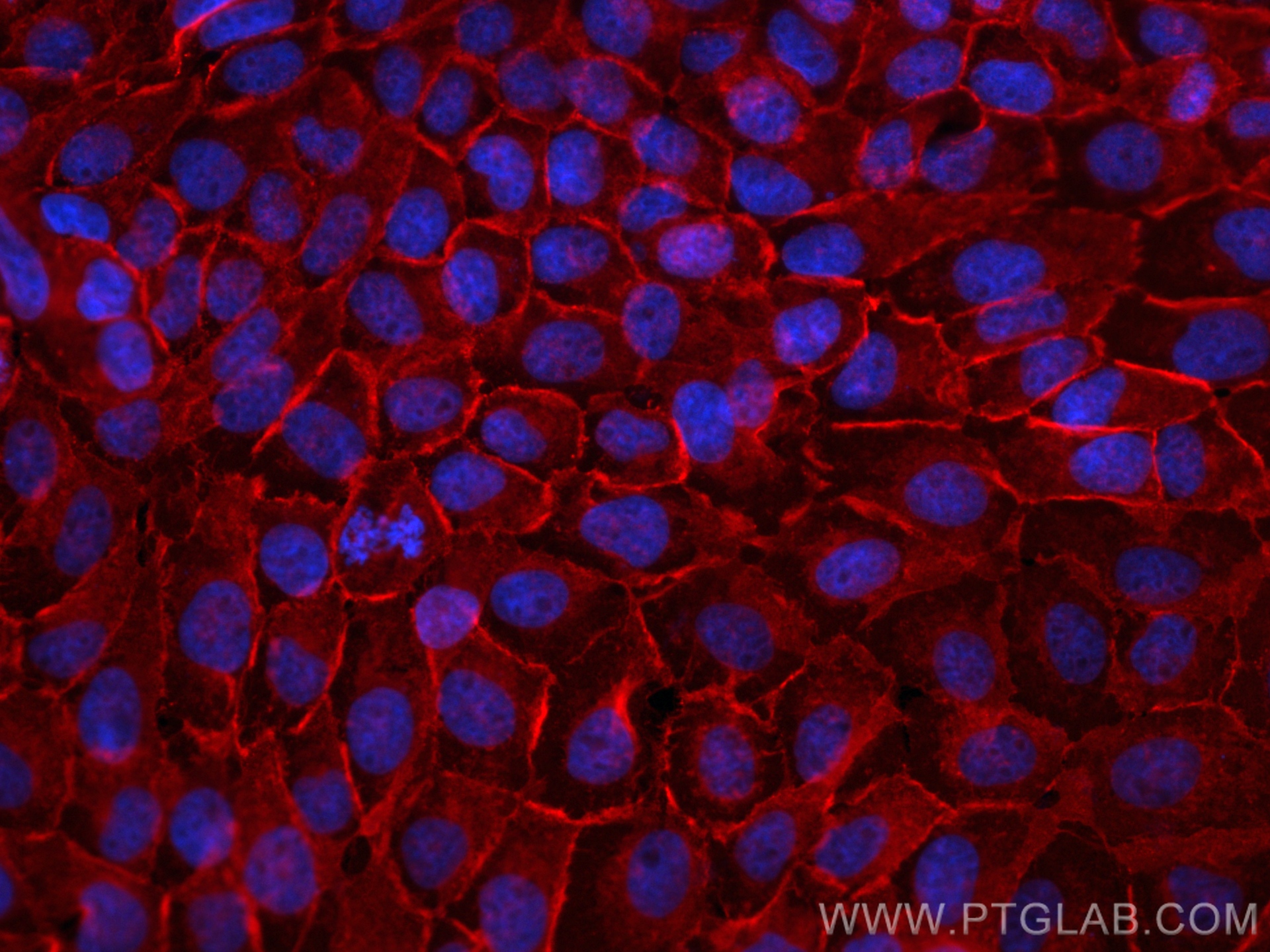 IF Staining of A431 using 11989-1-AP