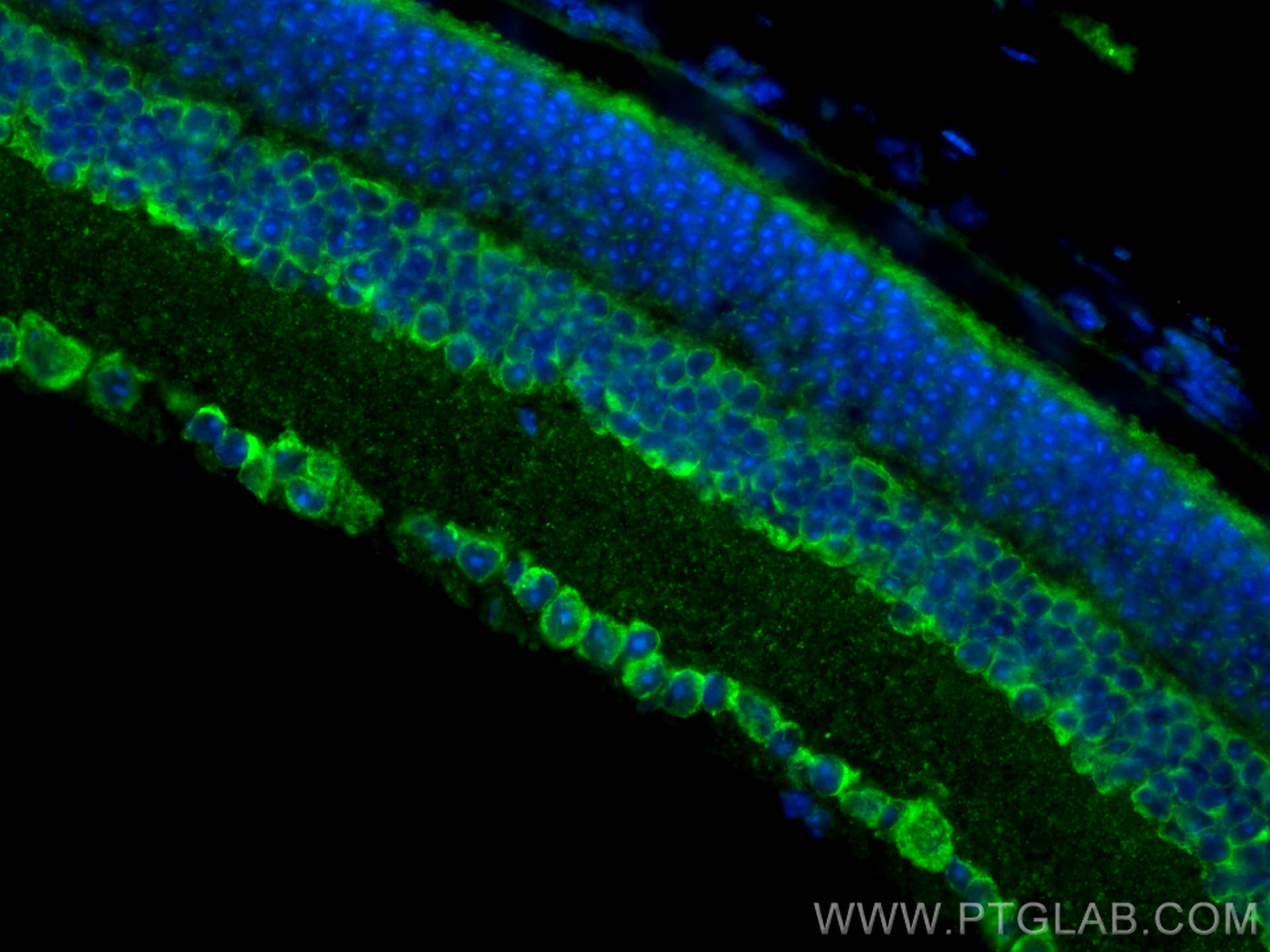 IF Staining of mouse eye using 13560-1-AP
