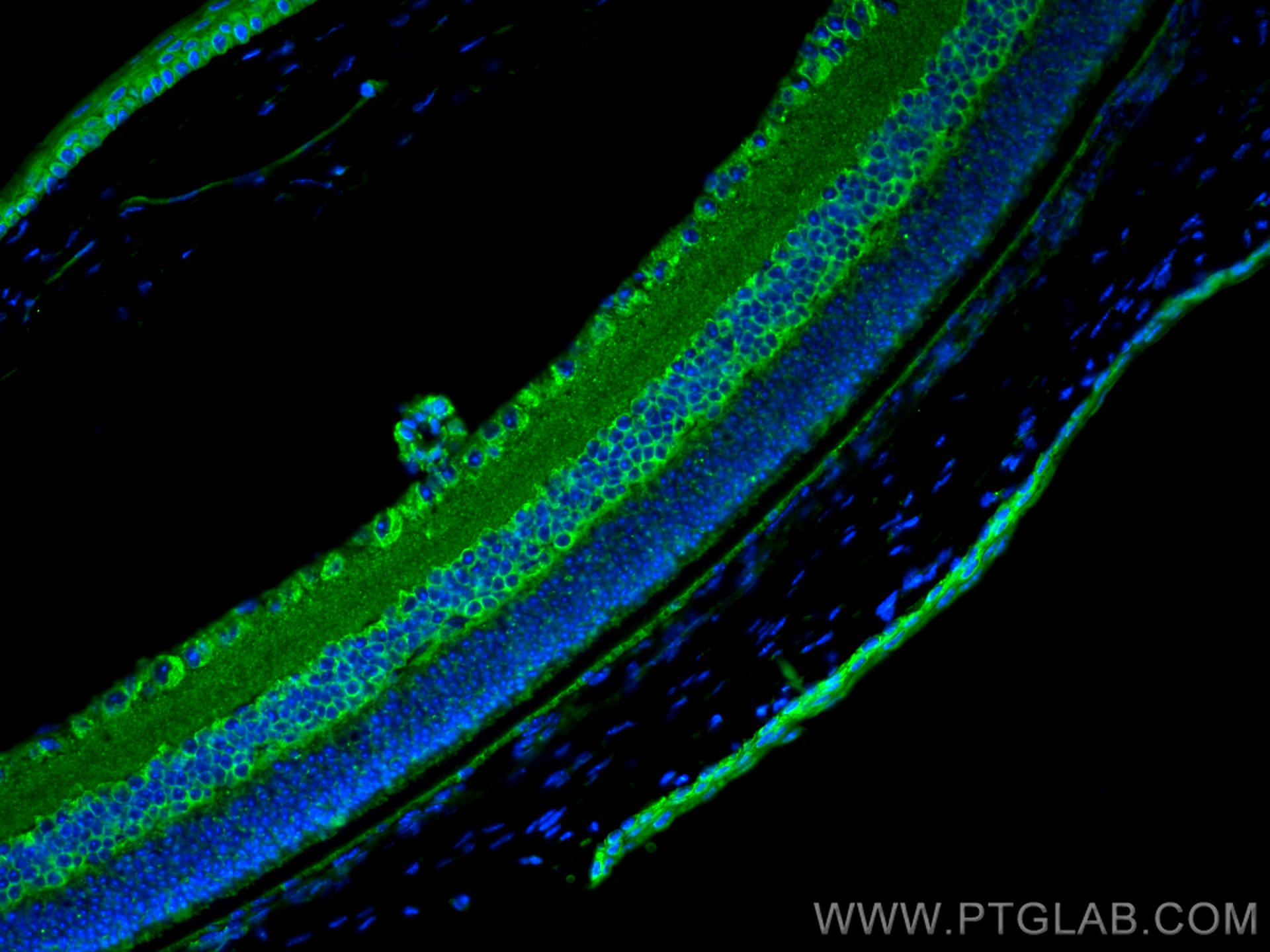 IF Staining of mouse eye using 30118-1-AP