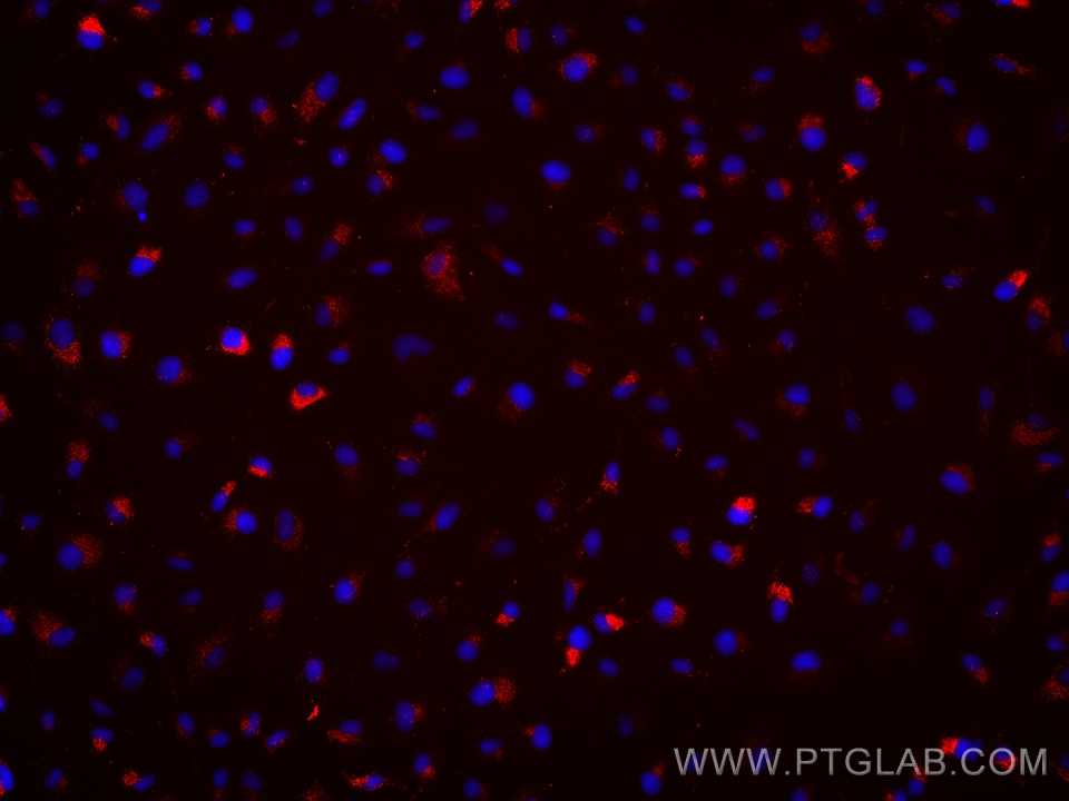 IF Staining of HeLa using 66919-1-Ig (same clone as 66919-1-PBS)