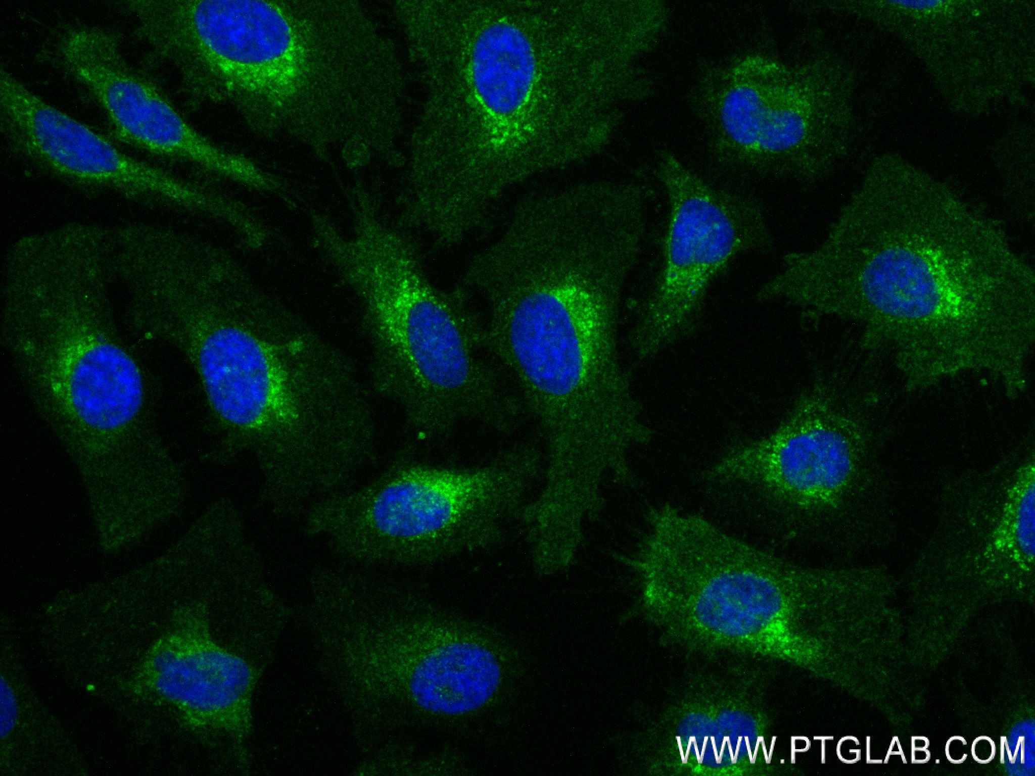 IF Staining of HeLa using 84190-7-RR (same clone as 84190-7-PBS)