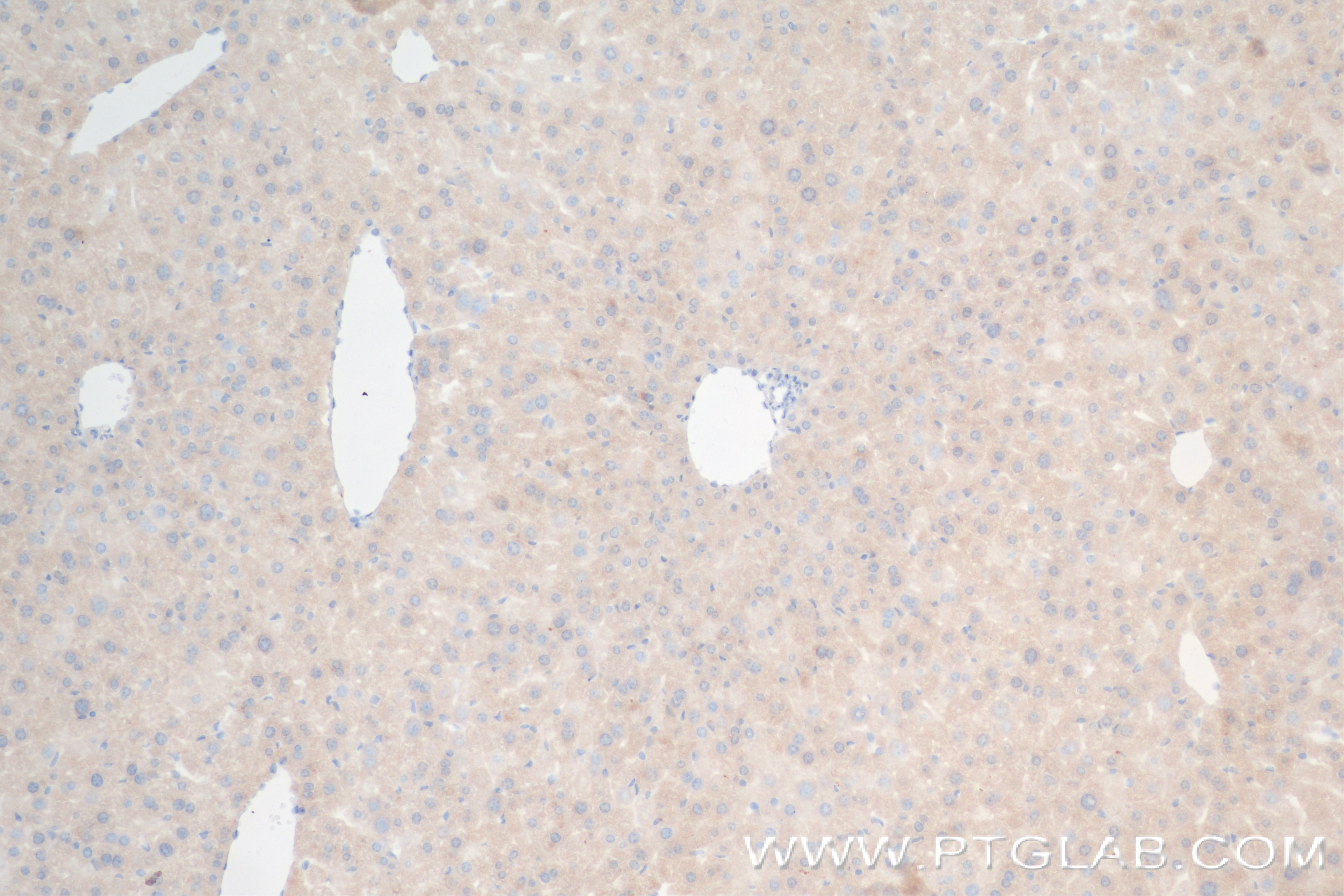 IHC staining of mouse liver using 84190-7-RR