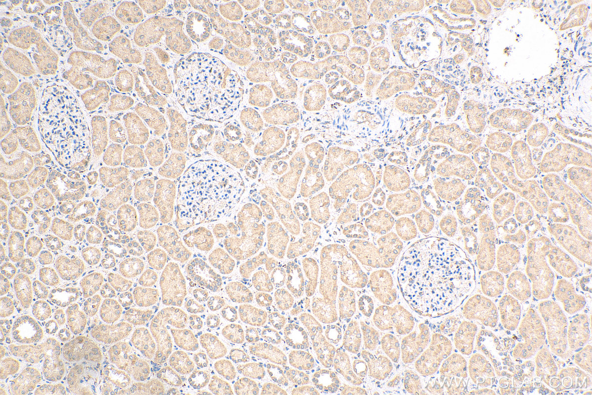 IHC staining of human kidney using 24733-1-AP