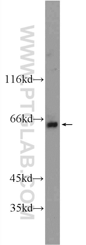 WB analysis of mouse testis using 24733-1-AP