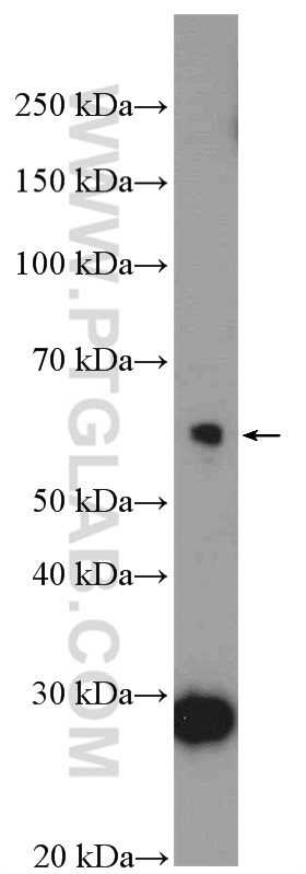 WB analysis of HepG2 using 13776-1-AP