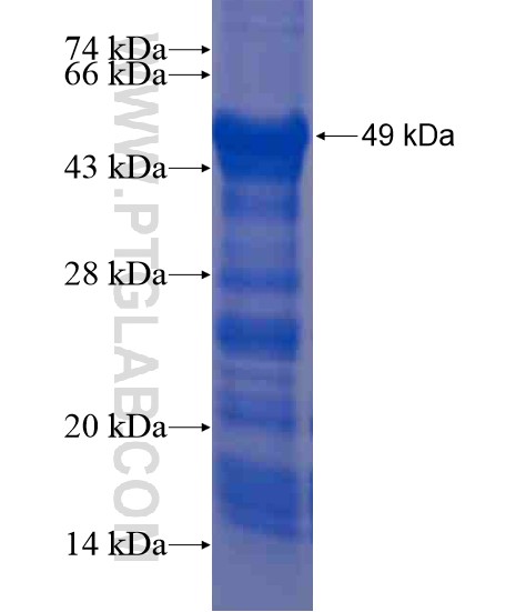 BTBD8 fusion protein Ag20960 SDS-PAGE