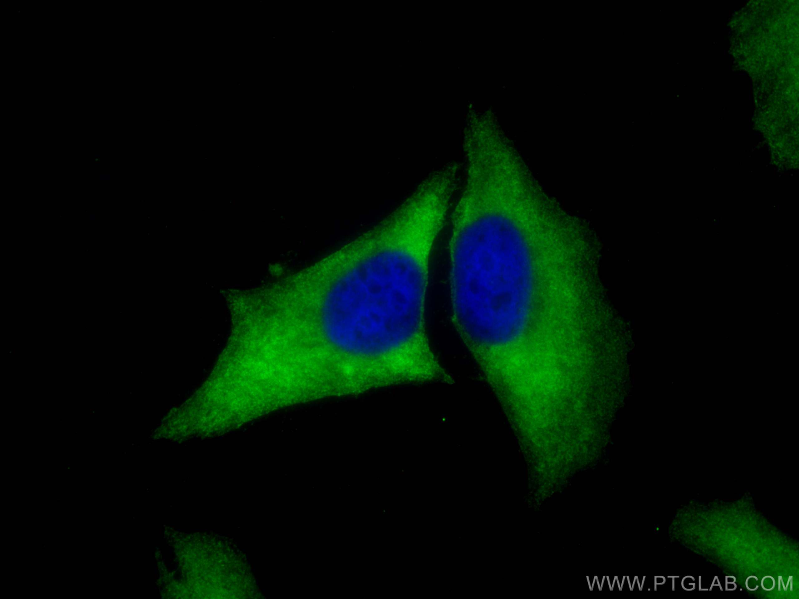 IF Staining of HeLa using 16330-1-AP