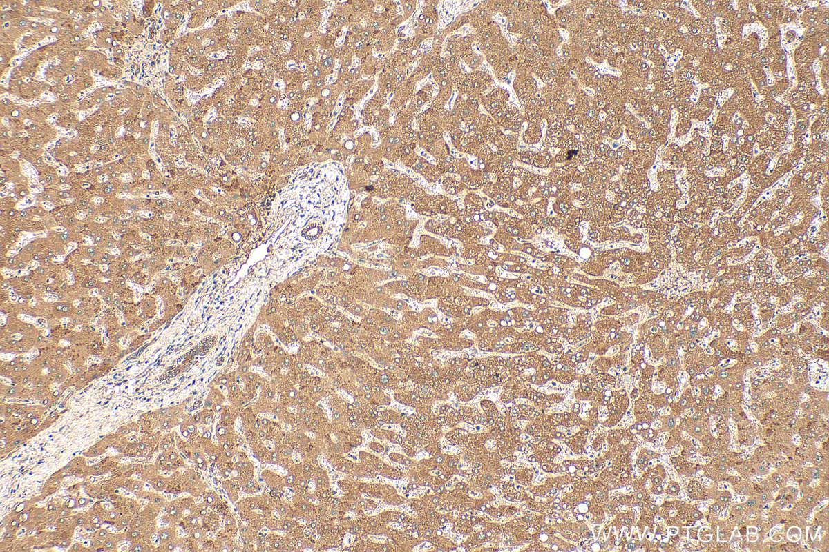 IHC staining of human liver using 16330-1-AP