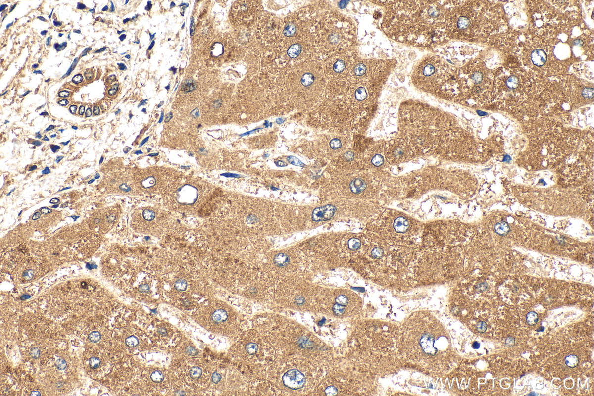 IHC staining of human liver using 16330-1-AP