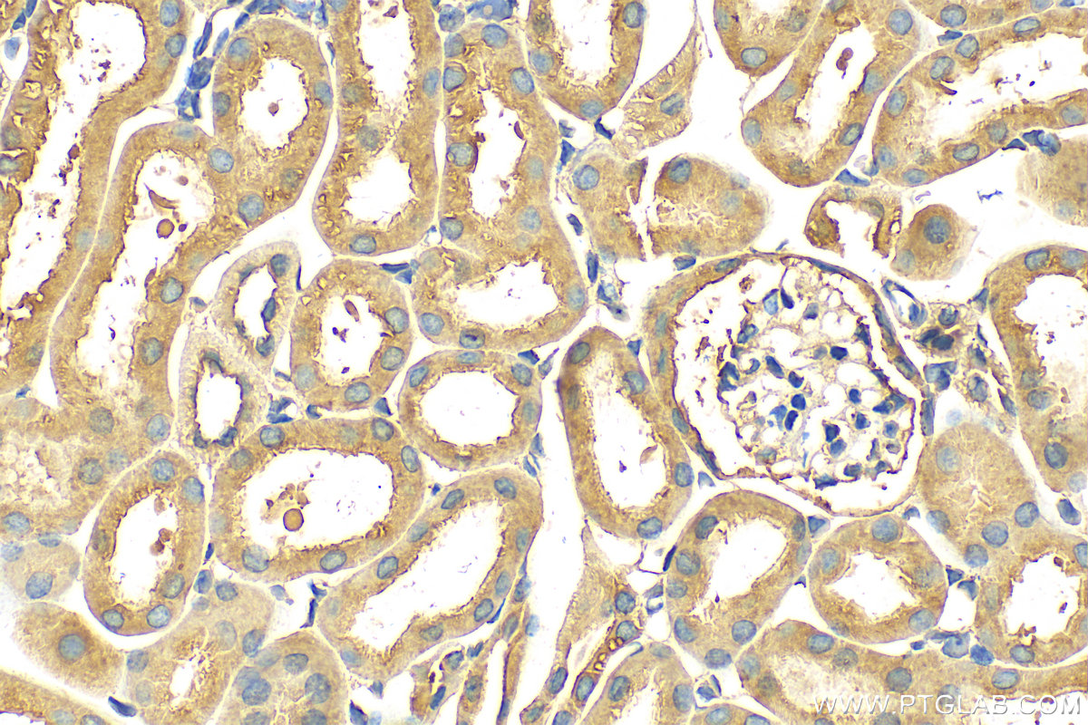 IHC staining of mouse kidney using 16330-1-AP