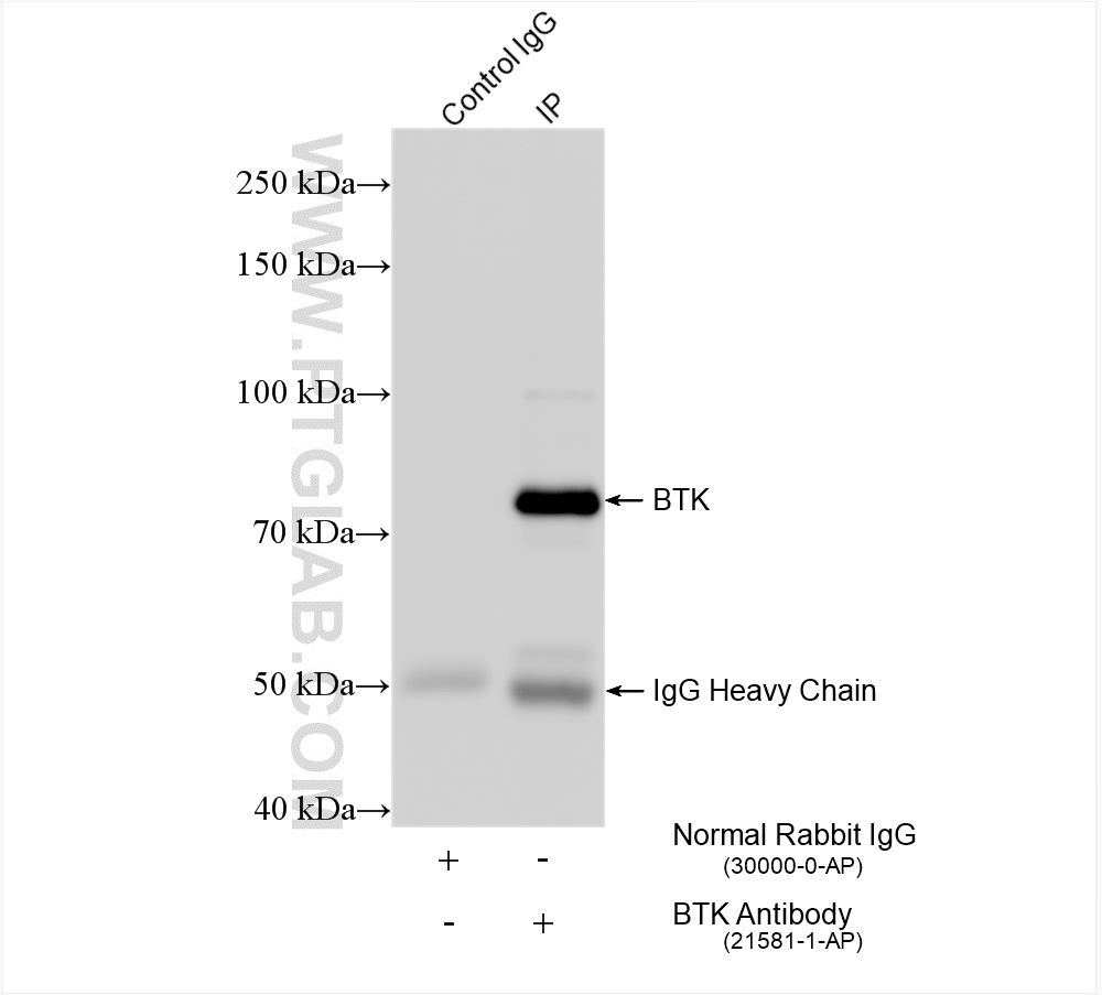 IP experiment of mouse spleen using 21581-1-AP