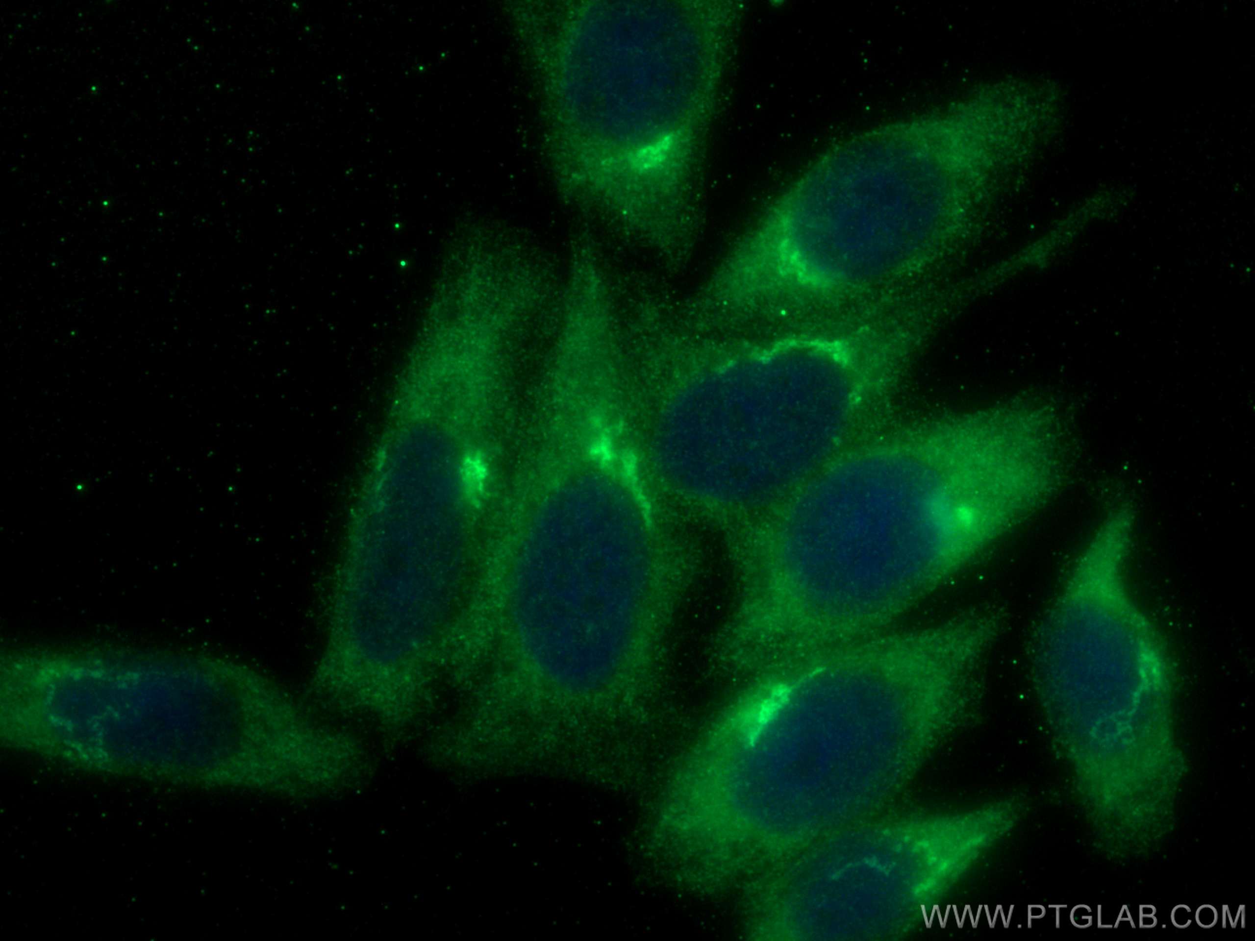 IF Staining of HepG2 using 16482-1-AP