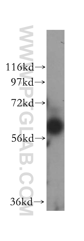 WB analysis of MCF-7 using 16482-1-AP