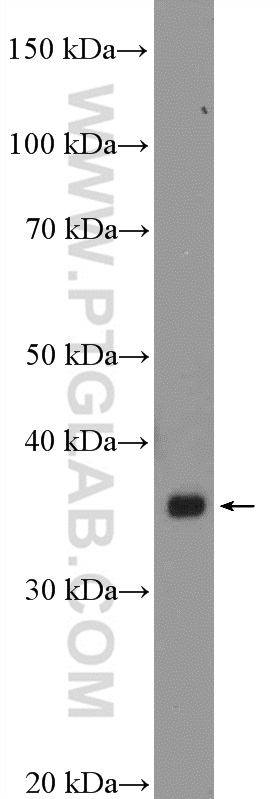 WB analysis of SKOV-3 using 15148-1-AP