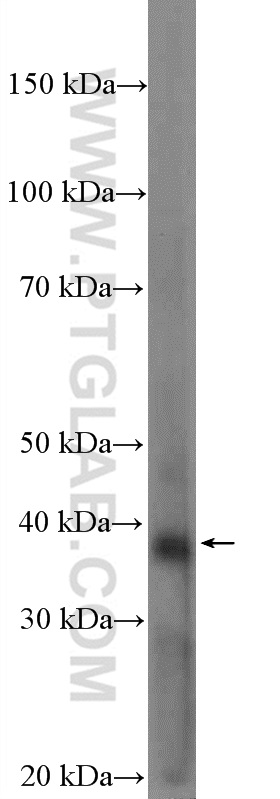 WB analysis of SKOV-3 using 15148-1-AP