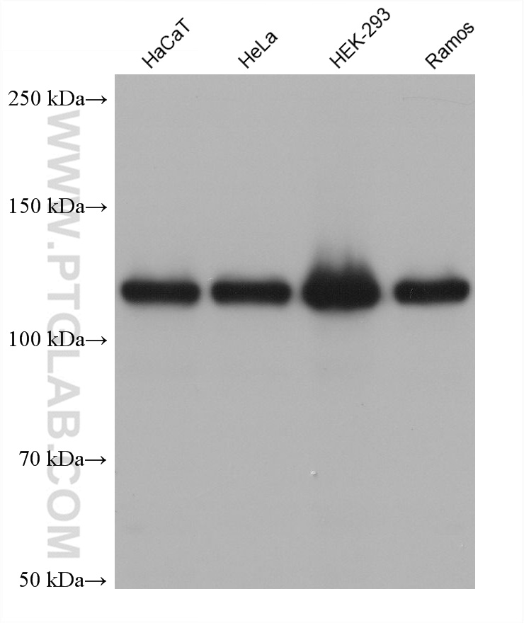 WB analysis using 60423-1-Ig (same clone as 60423-1-PBS)