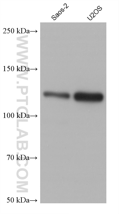 BUB1B