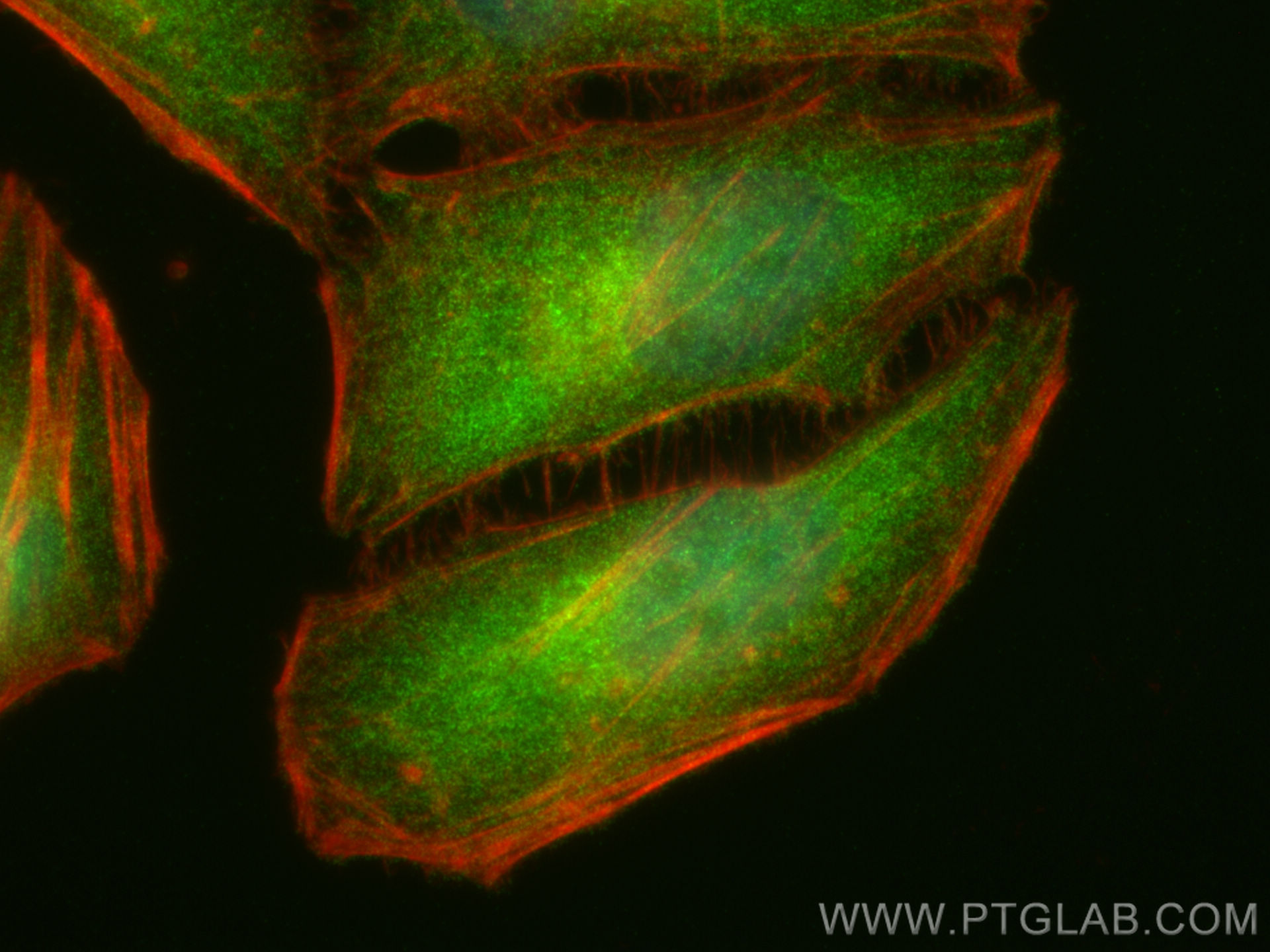 IF Staining of HeLa using 83920-6-RR