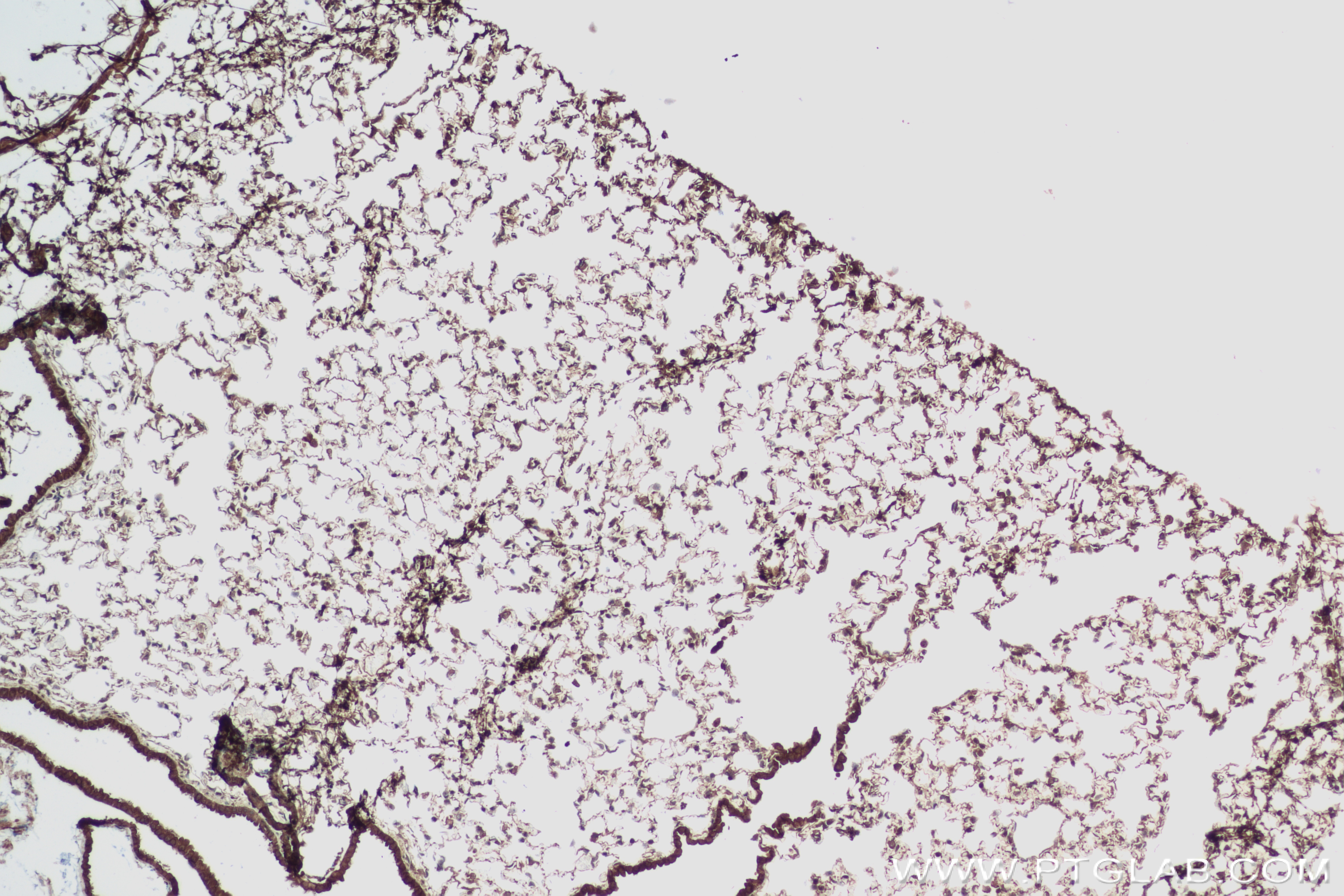 IHC staining of mouse lung using 83920-6-RR