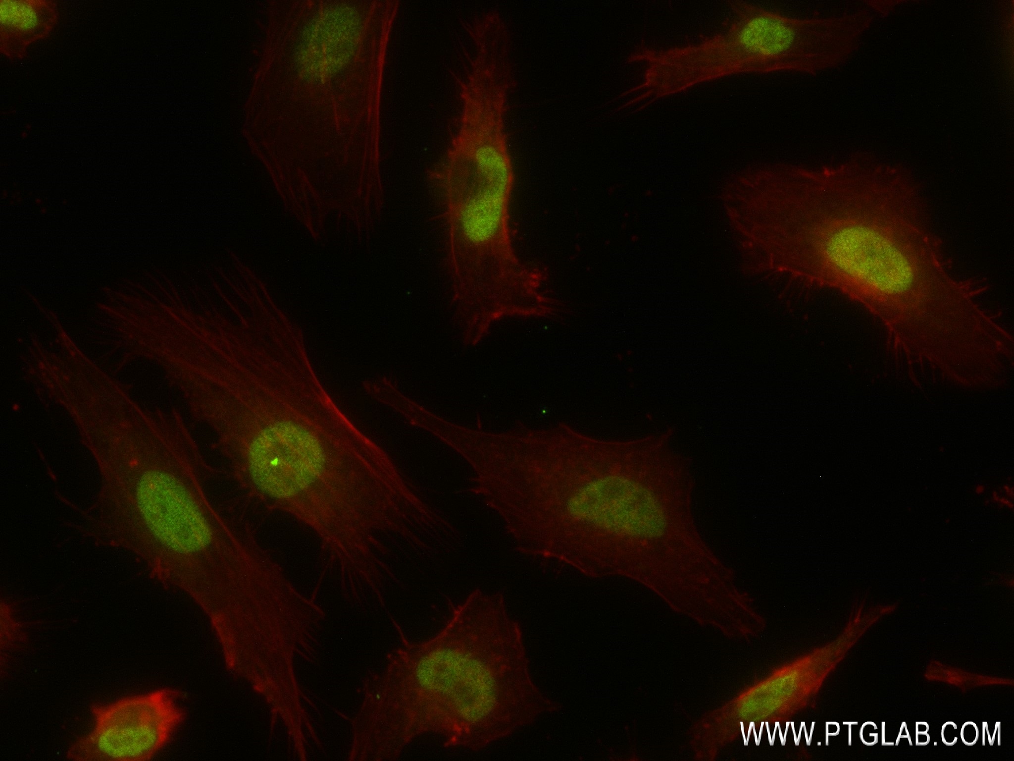 IF Staining of HeLa using 83266-5-RR