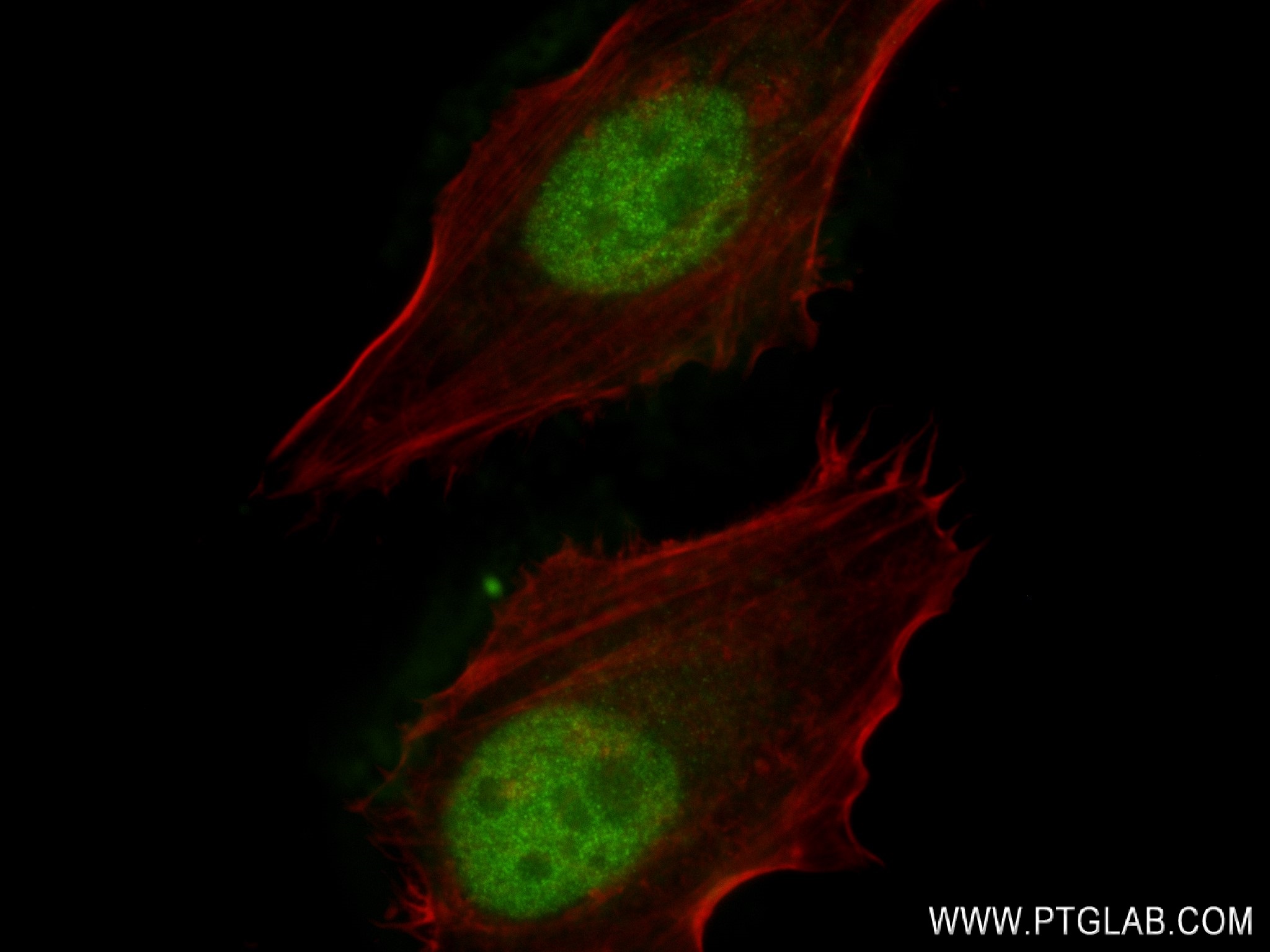 IF Staining of HeLa using 83266-5-RR