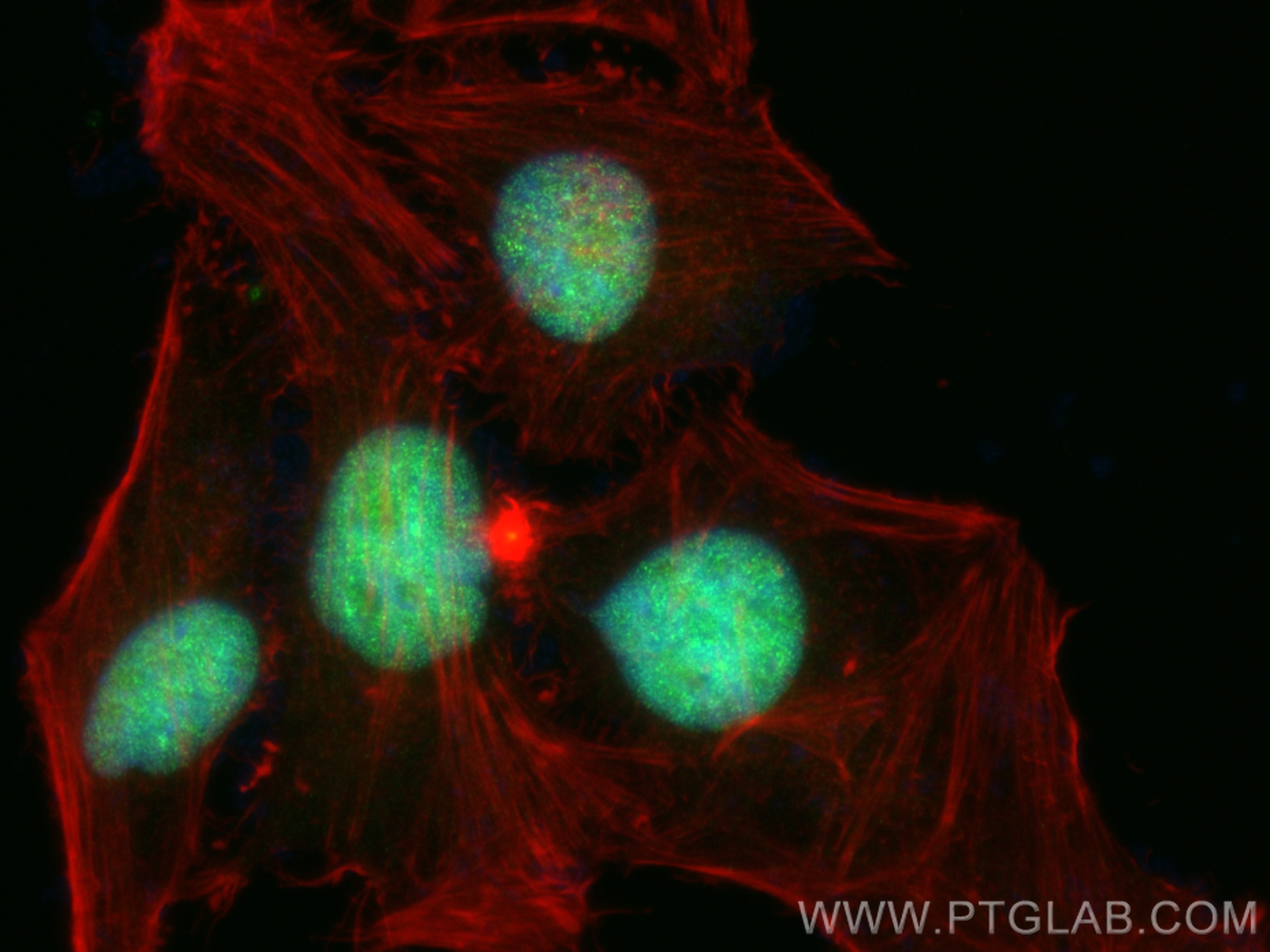 IF Staining of HeLa using 83266-5-RR