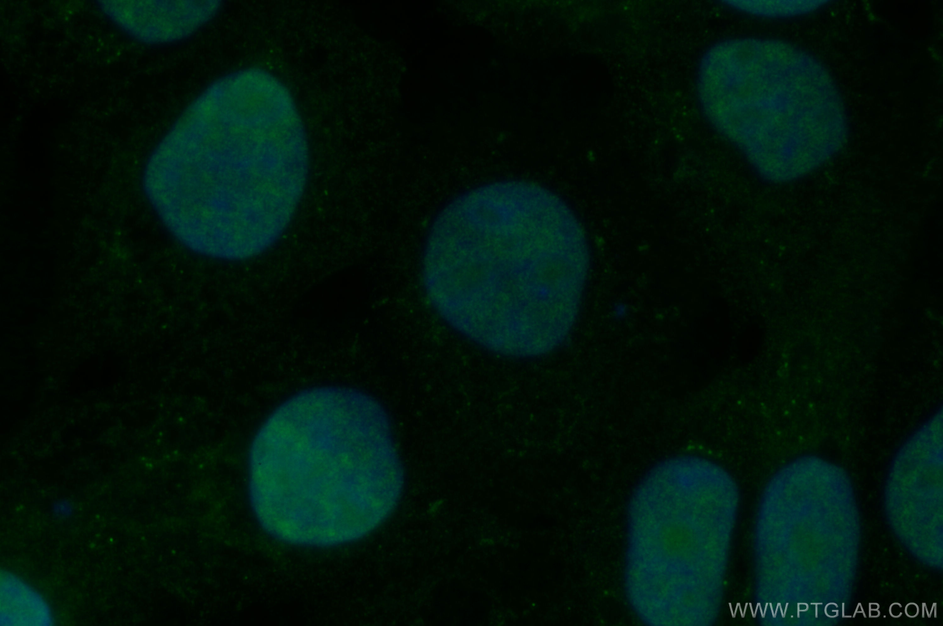 IF Staining of A431 using 20163-1-AP