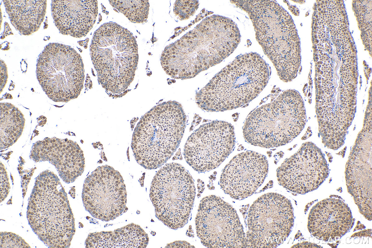 IHC staining of mouse testis using 20163-1-AP