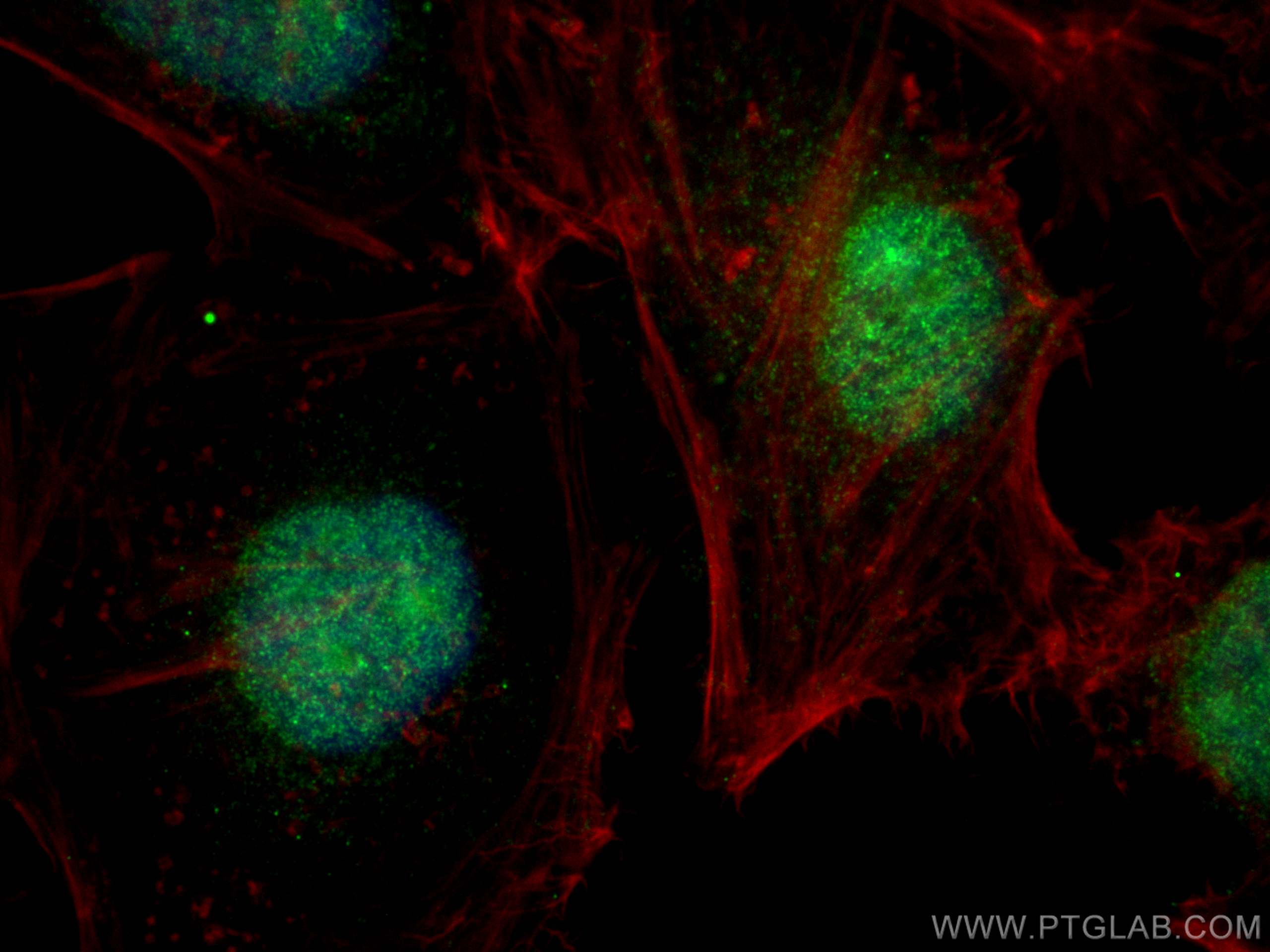 IF Staining of HeLa using 17584-1-AP