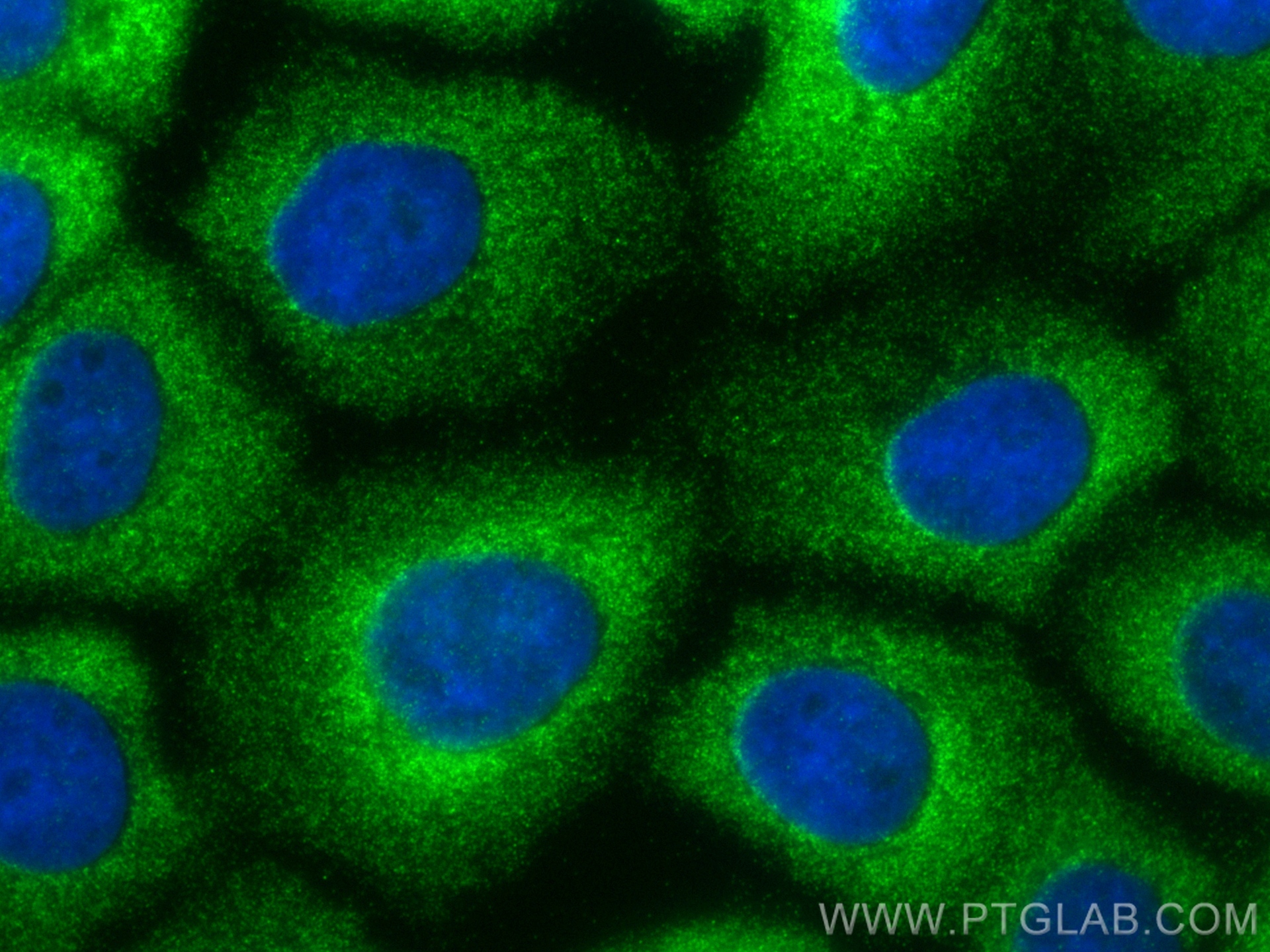 IF Staining of A431 using 19917-1-AP