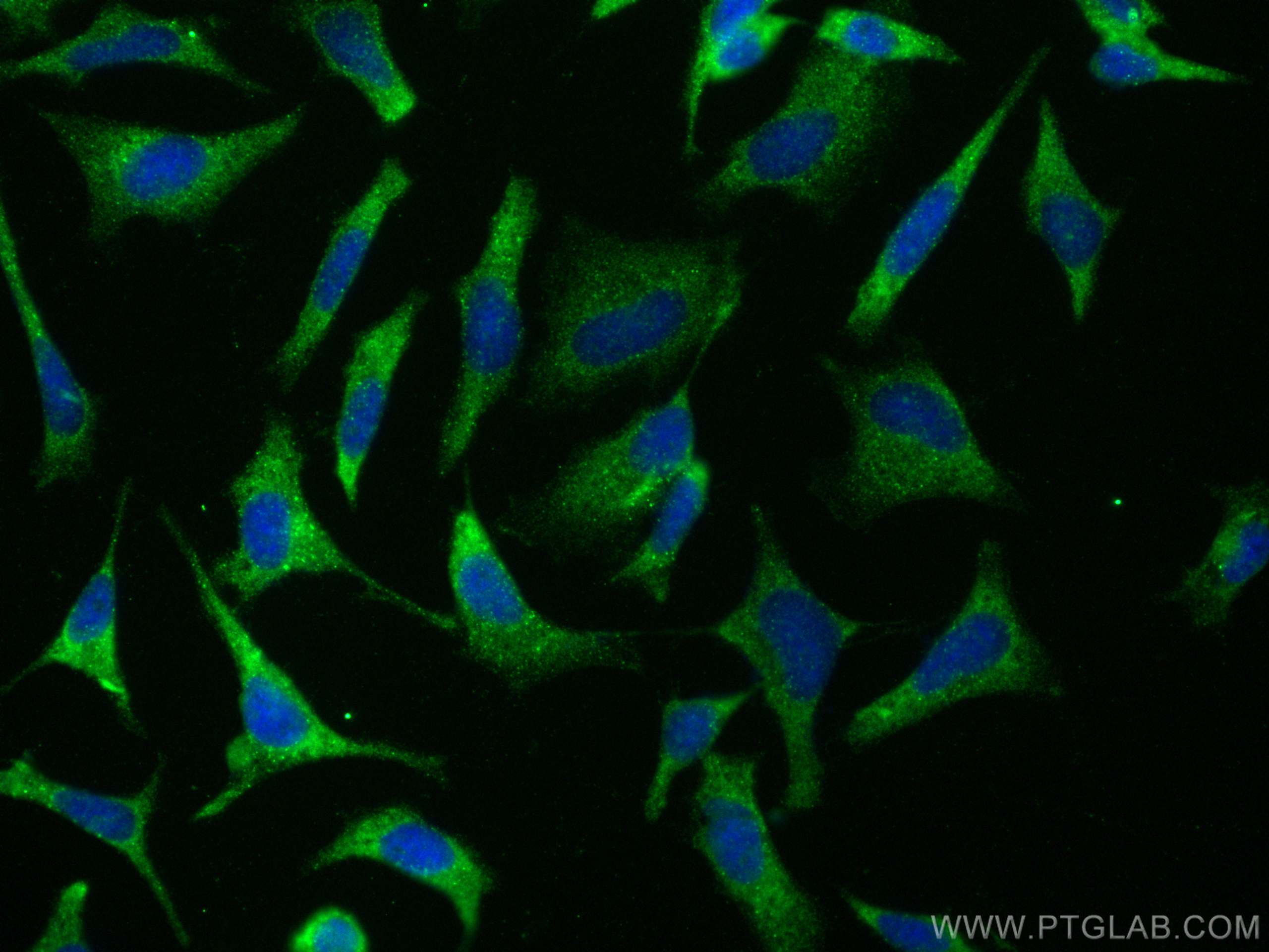 IF Staining of HeLa using 24412-1-AP