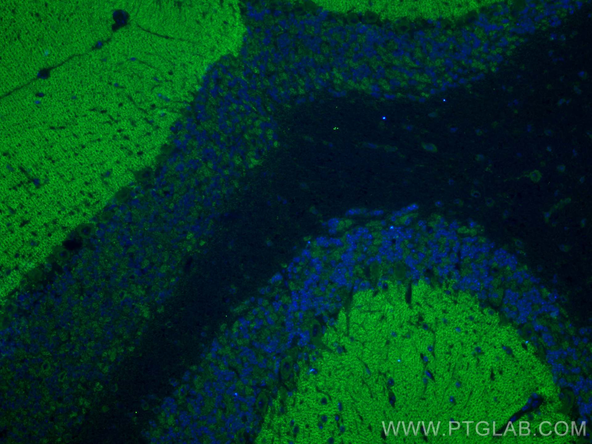 IF Staining of mouse cerebellum using 30392-1-AP