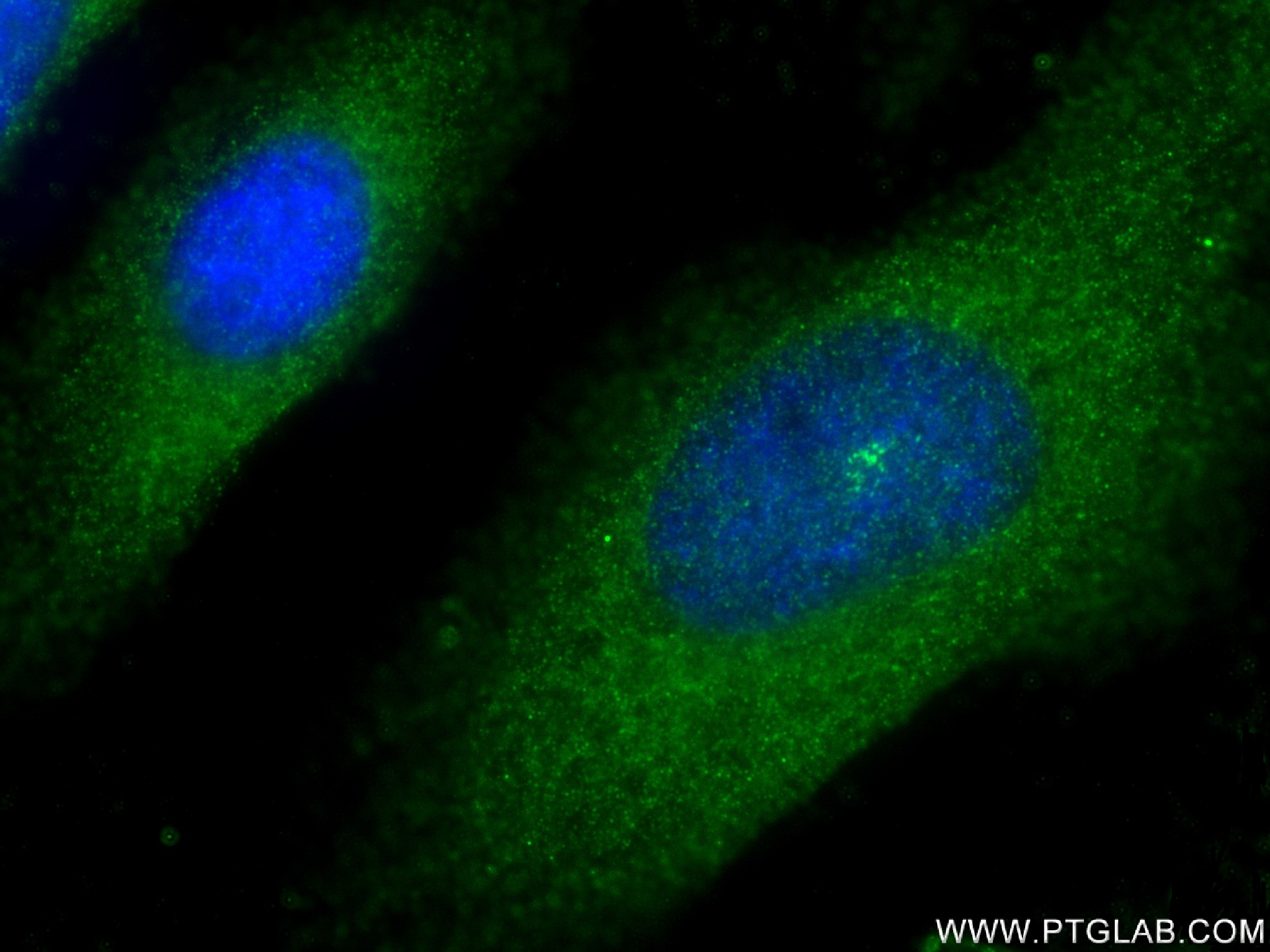 IF Staining of HeLa using 83330-1-RR (same clone as 83330-1-PBS)