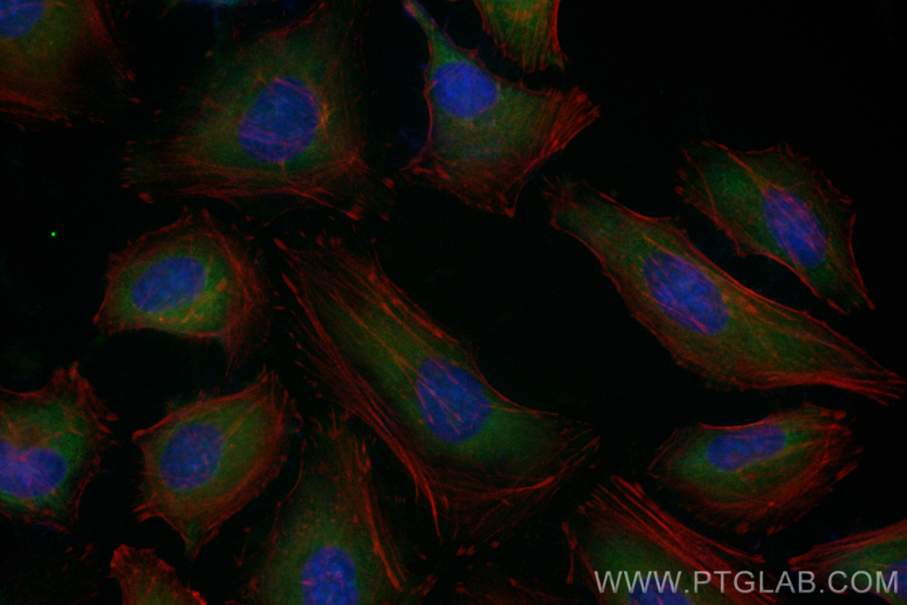 IF Staining of HeLa using CL488-83330-2