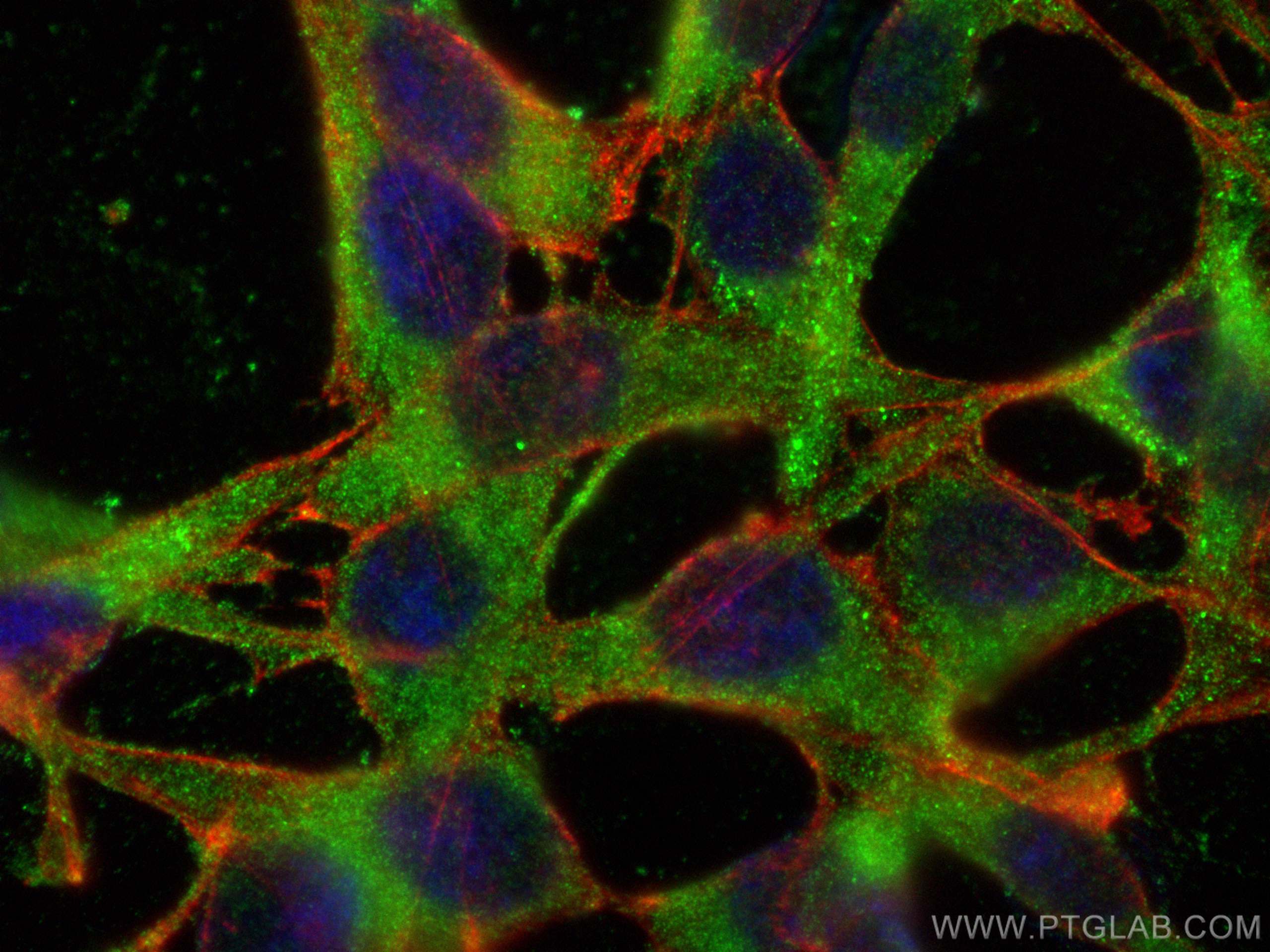 IF Staining of NIH/3T3 using 68103-1-Ig (same clone as 68103-1-PBS)