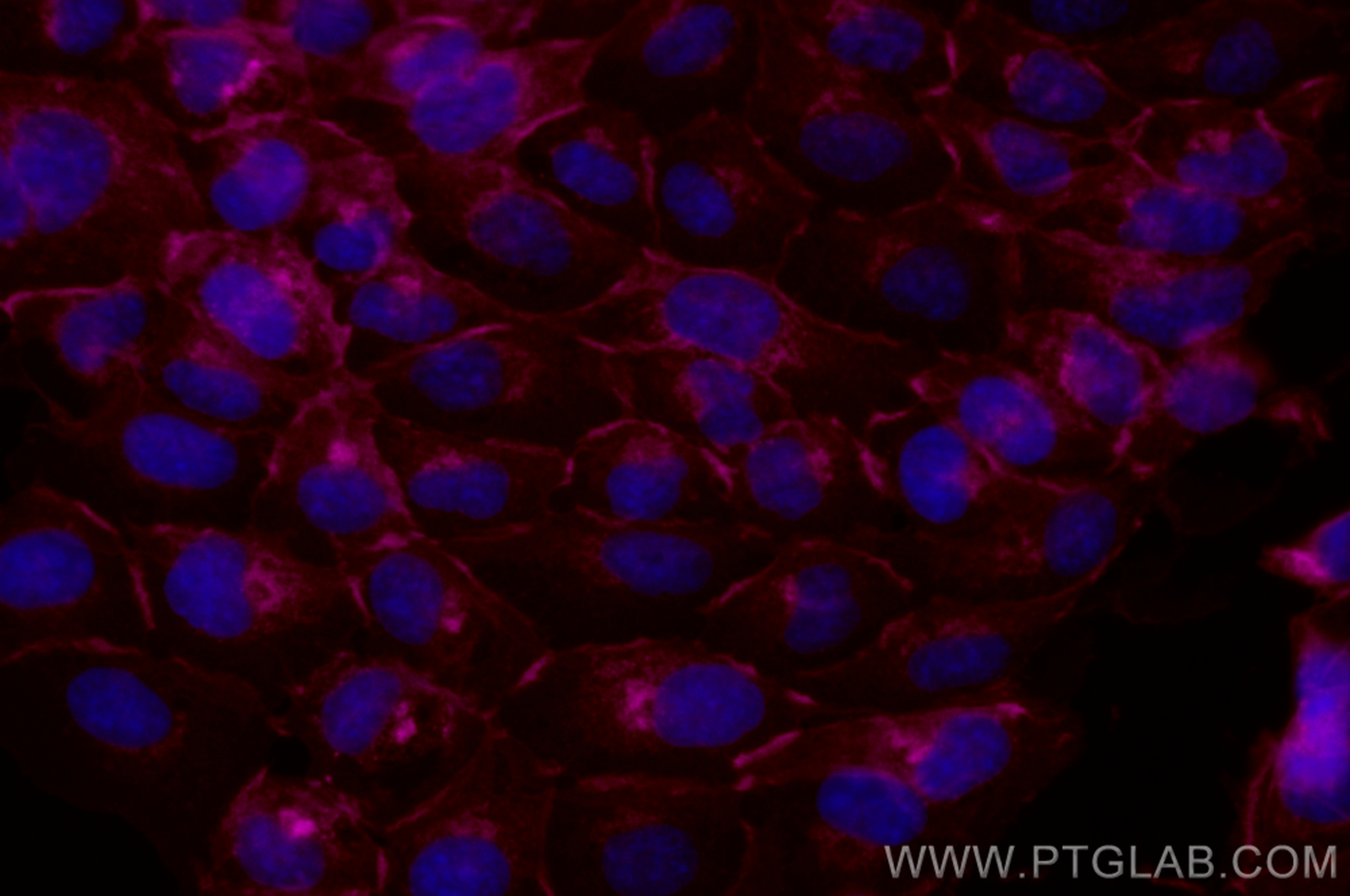 IF Staining of A431 using CL647-13511