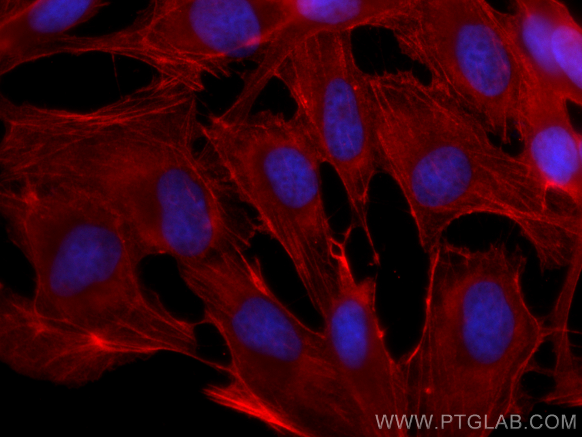 IF Staining of MDCK using CL594-81115