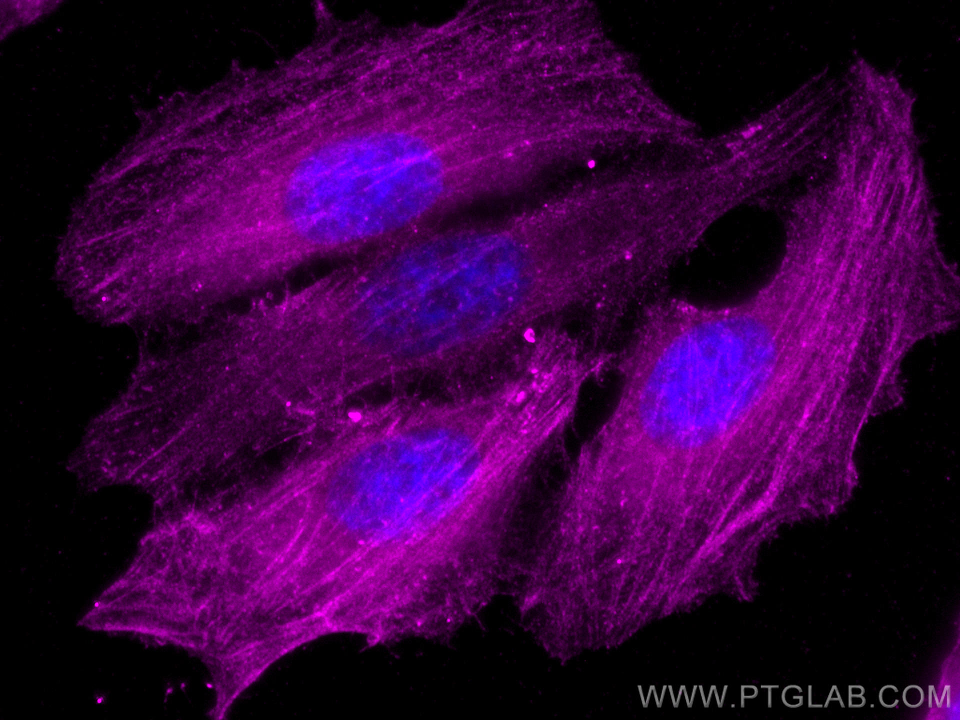 IF Staining of HepG2 using CL647-20536