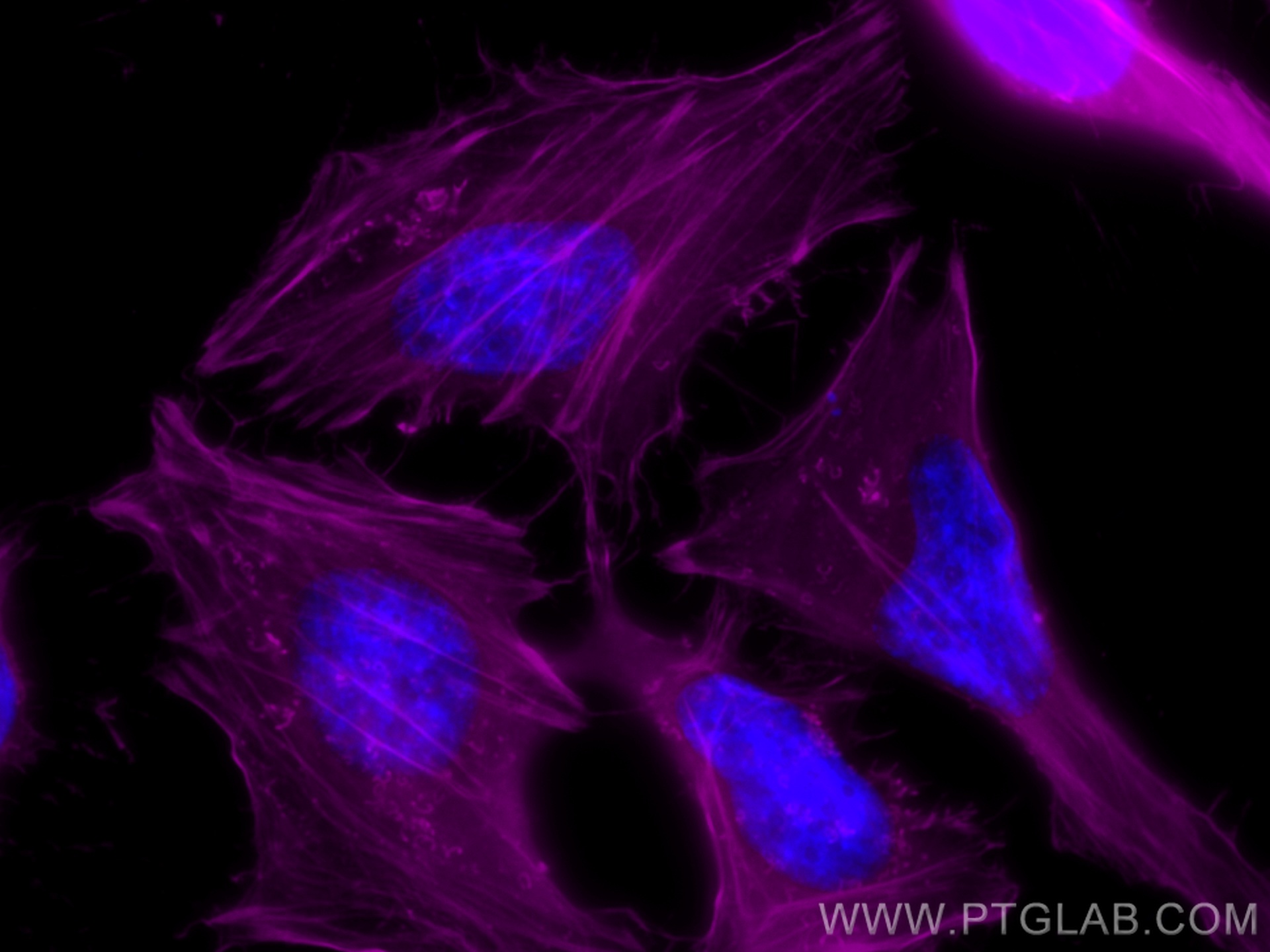 IF Staining of HeLa using CL647-66009