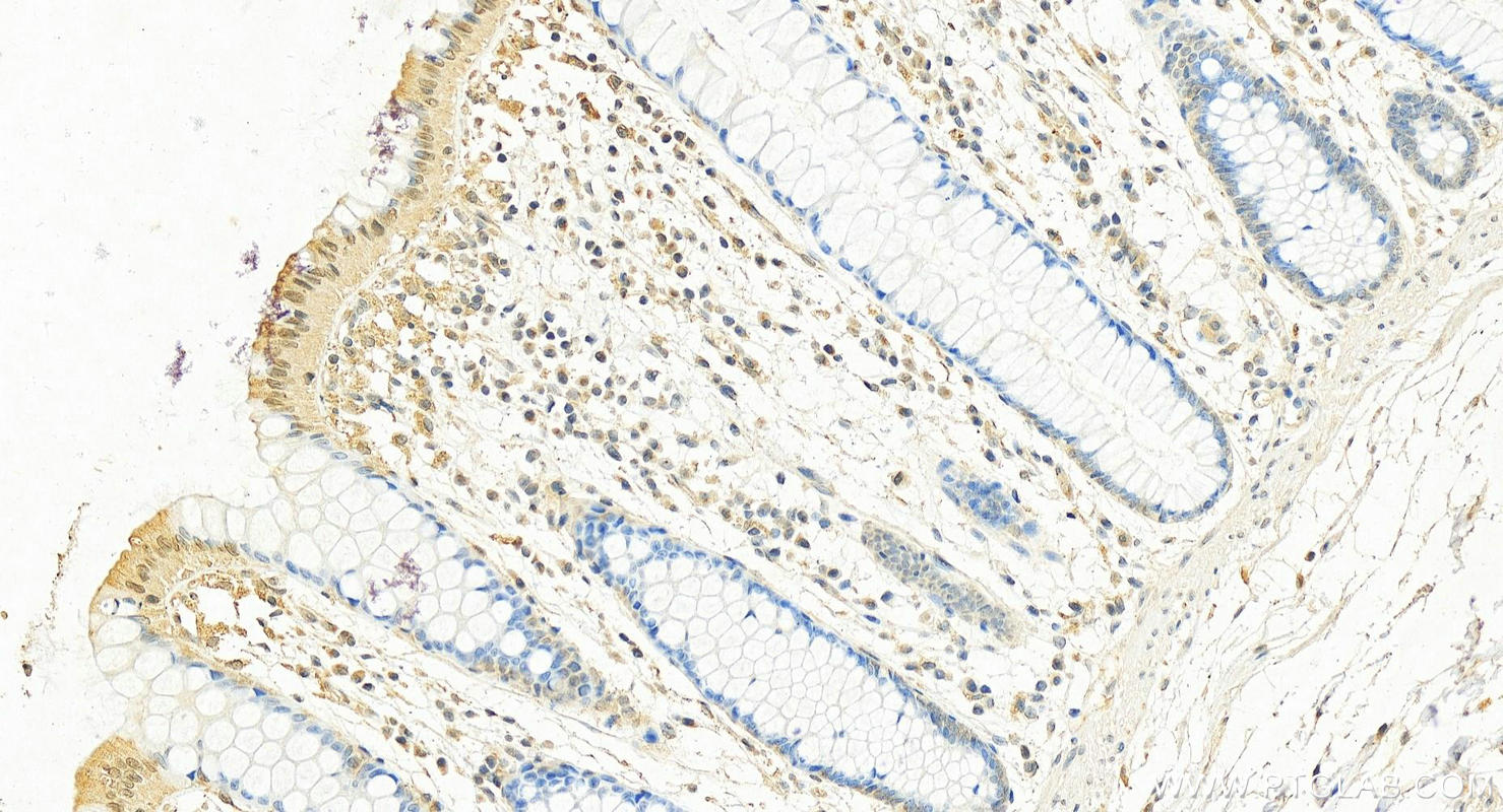 IHC staining of human colon using 68502-1-Ig (same clone as 68502-1-PBS)