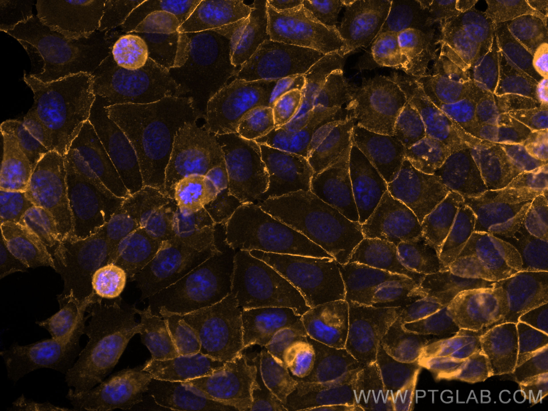 IF Staining of MCF-7 using CL555-51067