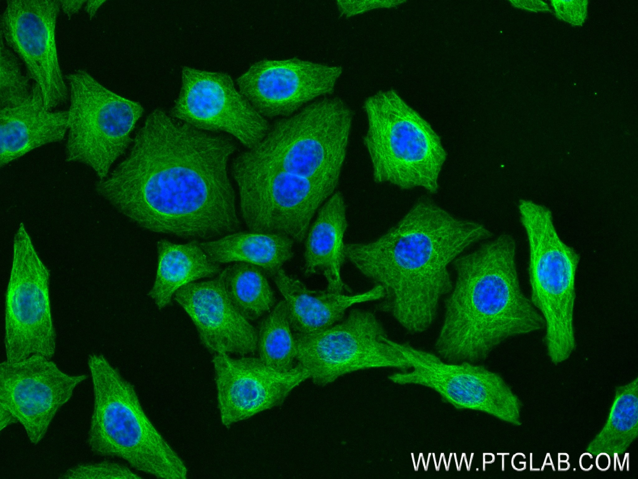 IF Staining of HepG2 using 80713-1-RR (same clone as 80713-1-PBS)